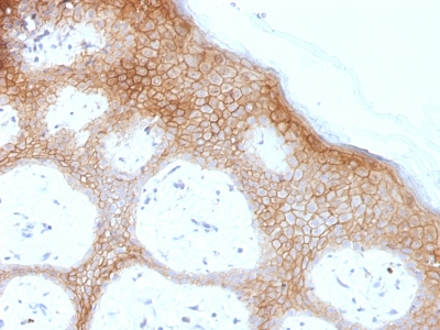 FFPE human skin sections stained with 100 ul anti-Desmoglein-1 (clone DSG1/1733) at 1:200. HIER epitope retrieval prior to staining was performed in 10mM Tris 1mM EDTA, pH 9.0.